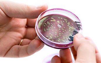 Prostatako jariatzean bakterioak